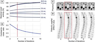 Bone Scintigraphy of Vertebral Fractures With a Whole-Body CZT Camera in a PET-Like Utilization